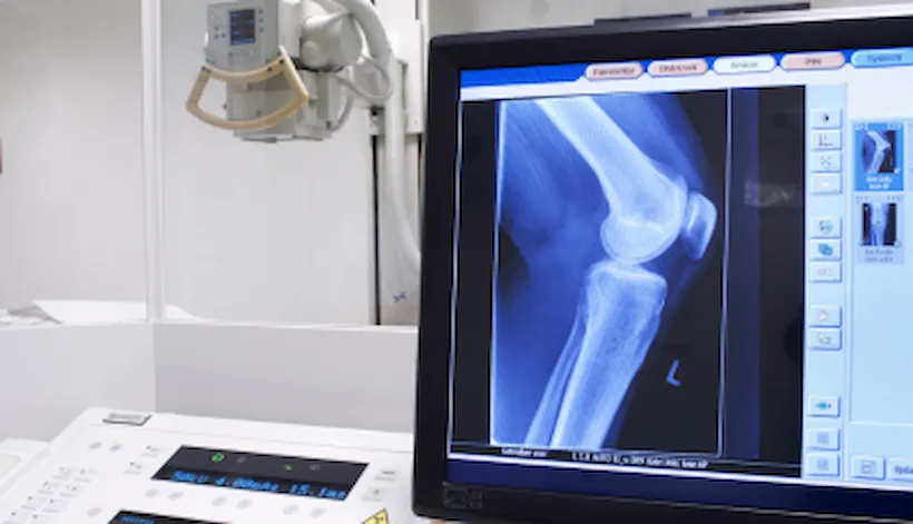 Advanced hip & knee replacement certification