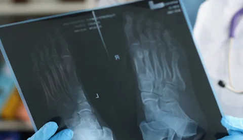Advanced foot & ankle surgery certification