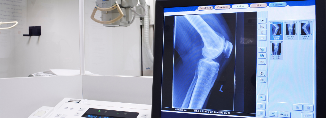 highlighted_hip_and_knee_joints_runners_pose